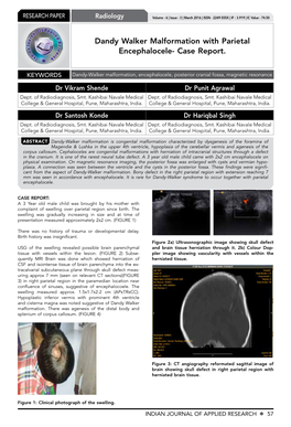 Dandy Walker Malformation with Parietal Encephalocele- Case Report