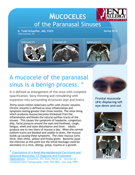 MUCOCELES of the Paranasal Sinuses