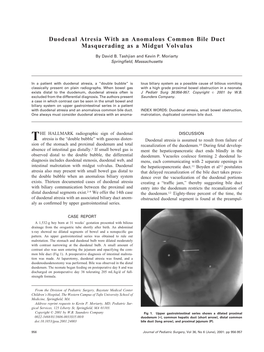 Duodenal Atresia with an Anomalous Common Bile Duct Masquerading As a Midgut Volvulus