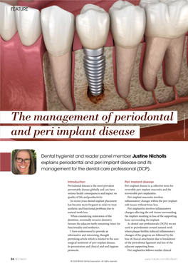 The Management of Periodontal and Peri Implant Disease