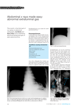 Abdominal X Rays Made Easy: Abnormal Extraluminal Gas