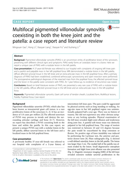 Multifocal Pigmented Villonodular Synovitis Coexisting in Both the Knee