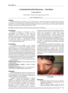 A Misleading Periorbital Hematoma…..Case Report