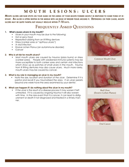 MOUTH LESIONS: ULCERS Mouth Ulcers Are Raw Spots on Your Gums Or the Lining of Your Mouth Formed Mostly in Response to Some Form of Ir- Ritant