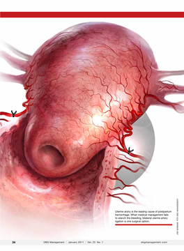 Postpartum Hemorrhage: 11 Critical Questions, Answered by an Expert