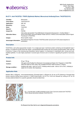 Anti-TACSTD2 / TROP2 (Epithelial Marker) Monoclonal Antibody(Clone: TACSTD2/2151)