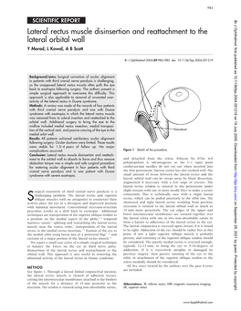 Lateral Rectus Muscle Disinsertion and Reattachment to the Lateral Orbital Wall Y Morad, L Kowal, a B Scott