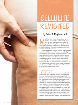 CELLULITE REVISITED by Peter T