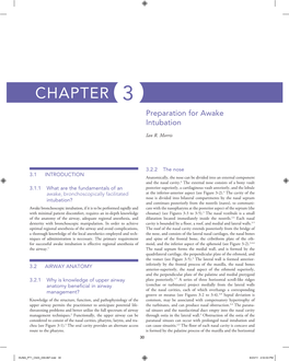 Chapter 3 Preparation for Awake Intubation