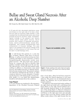 Bullae and Sweat Gland Necrosis After an Alcoholic Deep Slumber