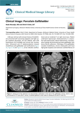 Porcelain Gallbladder Nada Mustafa, MD and Shinil K Shah, DO*