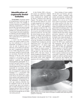 Identification of Legionella Feeleii Cellulitis