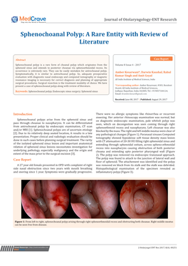 Sphenochoanal Polyp: a Rare Entity with Review of Literature