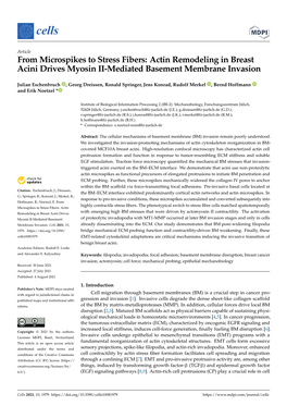 From Microspikes to Stress Fibers: Actin Remodeling in Breast Acini Drives Myosin II-Mediated Basement Membrane Invasion