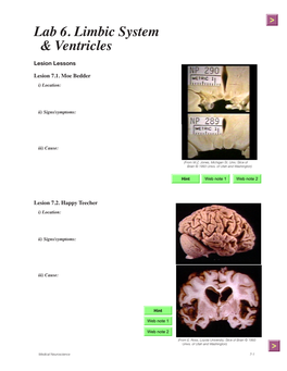 Lab 6. Limbic System & Ventricles