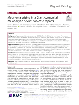 Melanoma Arising in a Giant Congenital Melanocytic Nevus: Two Case Reports Tatiana S