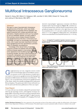 Multifocal Intraosseous Ganglioneuroma