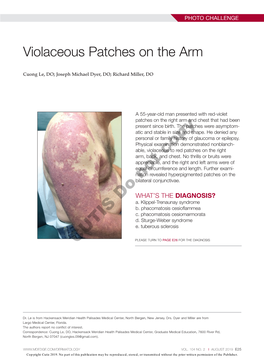 Violaceous Patches on the Arm