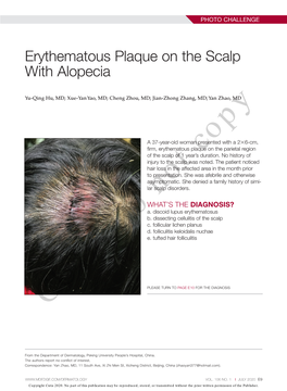 Erythematous Plaque on the Scalp with Alopecia