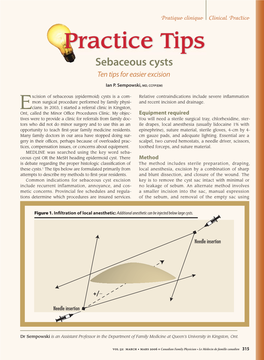 Practice Tips Sebaceous Cysts Ten Tips for Easier Excision