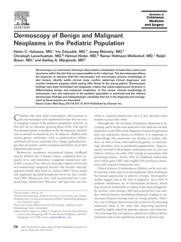 Dermoscopy of Benign and Malignant Neoplasms in the Pediatric Population Helen C