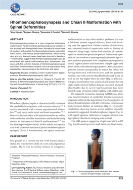 Rhombencephalosynapsis and Chiari II Malformation with Spinal Deformities 1Abul Hasan, 2Sanjeev Shopra, 3Devendra K Purohit, 4Somnath Sharma