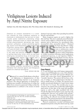 Vitiliginous Lesions Induced by Amyl Nitrite Exposure