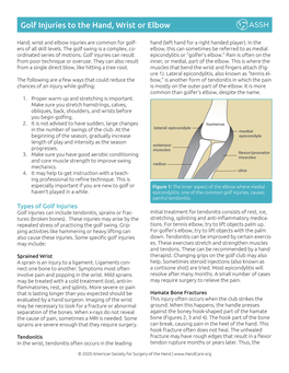 Golf Injuries to the Hand, Wrist Or Elbow