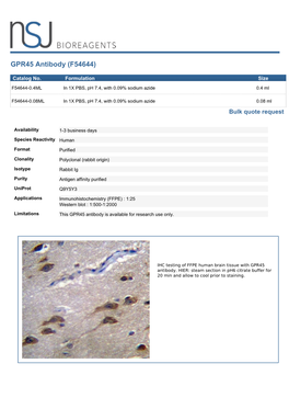 GPR45 Antibody (F54644)