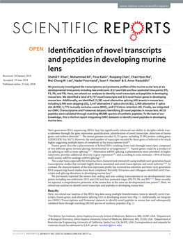 Identification of Novel Transcripts and Peptides in Developing Murine Lens