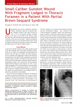 Small-Caliber Gunshot Wound with Fragment Lodged in Thoracic Foramen in a Patient with Partial Brown-Sequard Syndrome