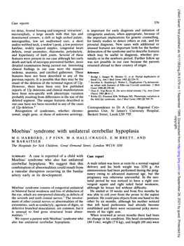 Moebius' Syndrome with Unilateral Cerebellar Hypoplasia M G HARBORD, J P FINN