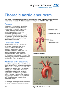 Thoracic Aortic Aneurysm