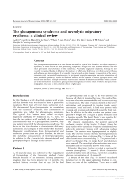 The Glucagonoma Syndrome and Necrolytic Migratory Erythema