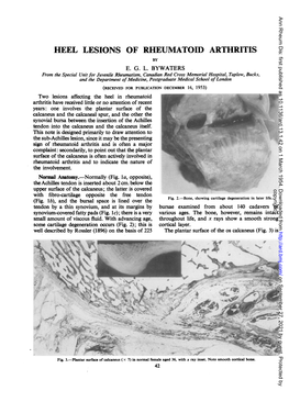 Heel Lesions of Rheumatoid Arthritis by E