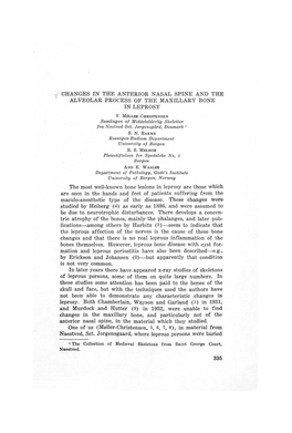 Changes in the Anterior Nasal Spine and the Alveolar Process of the Maxillary Bone in Leprosy