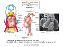 It Should Be Noted That the Atrium and the Sinus Come to Lie Behind and Above the Ventricle