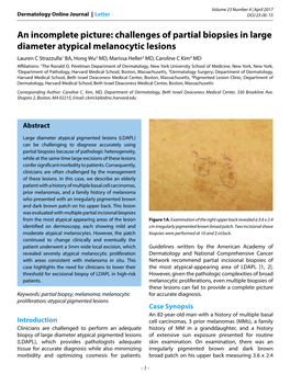 Challenges of Partial Biopsies in Large Diameter Atypical