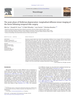 The Acute Phase of Wallerian Degeneration: Longitudinal Diffusion Tensor Imaging of the Fornix Following Temporal Lobe Surgery