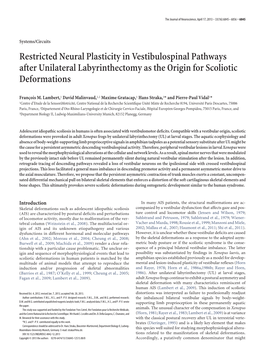 Restricted Neural Plasticity in Vestibulospinal Pathways After Unilateral Labyrinthectomy As the Origin for Scoliotic Deformations