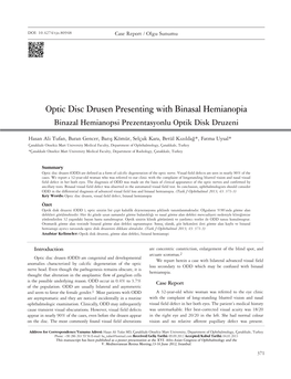 Optic Disc Drusen Presenting with Binasal Hemianopia Binazal Hemianopsi Prezentasyonlu Optik Disk Druzeni