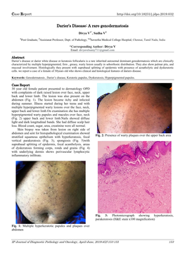 Darier's Disease Maps to Premature Keratinization, Presence of Villi, Corps, Ronds and Chromosome12q23-Q24.1