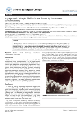 Asymptomatic Multiple Bladder Stones Treated by Percutaneous