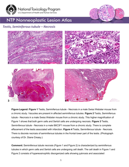 Testis, Seminiferous Tubule – Necrosis