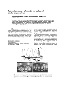 Biomechanics of Orthodontic Correction of Dental Asymmetries