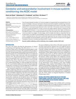 Cerebellar and Extracerebellar Involvement in Mouse Eyeblink Conditioning: the ACDC Model