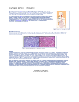 Esophageal Cancer: Introduction