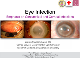 Eye Infection Emphasis on Conjunctival and Corneal Infections