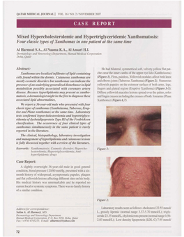 Four Classic Types of Xanthomas in One Patient at the Same Time