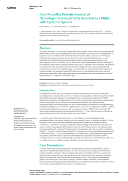 Beta-Propeller Protein-Associated Neurodegeneration (BPAN) Detected in a Child with Epileptic Spasms